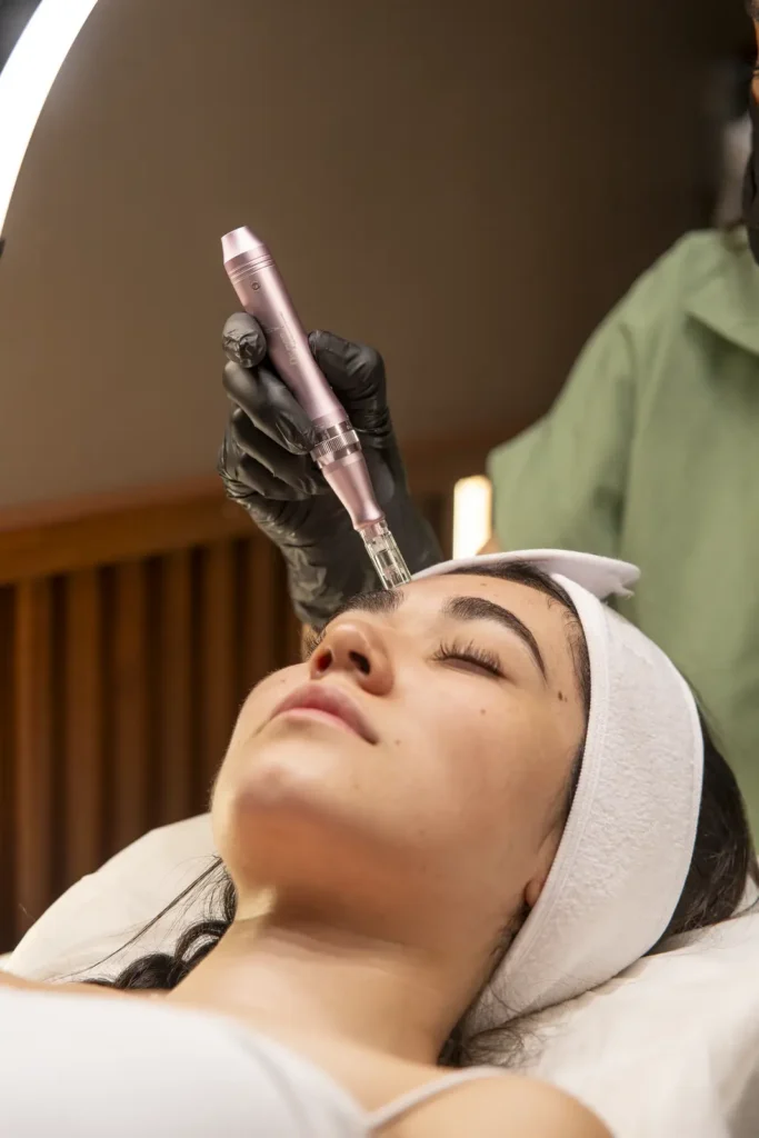 Experiencia Dermapen con Células Madre en Aira