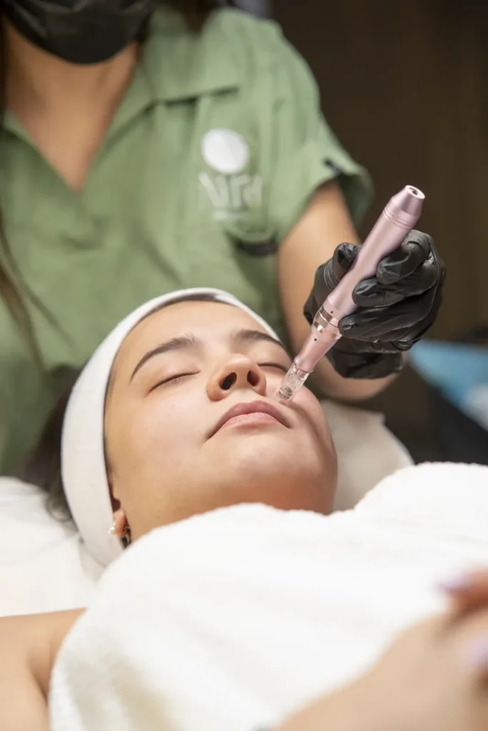 Experiencia Dermapen PDRN de Salmón en Aira