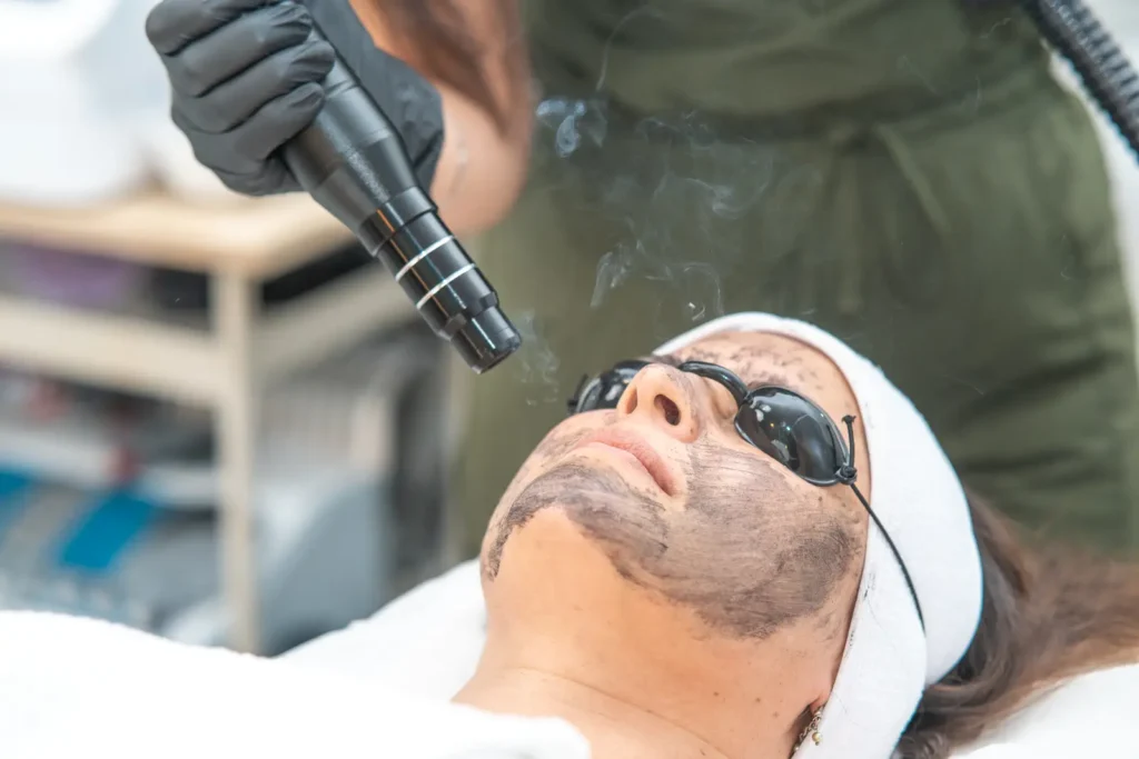 Experiencia Hollywood Peel en Aira